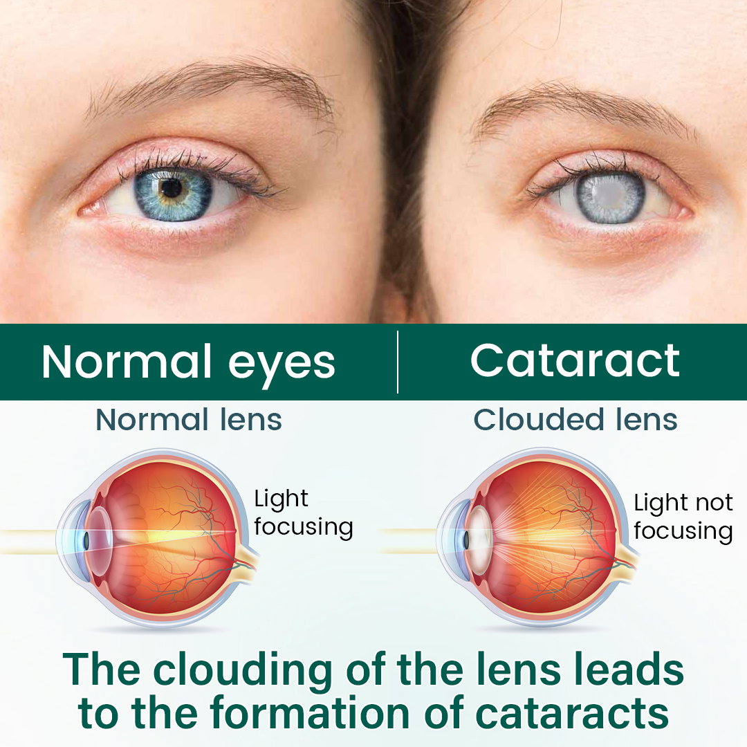OptiClear Nano Eye Roller Serum
