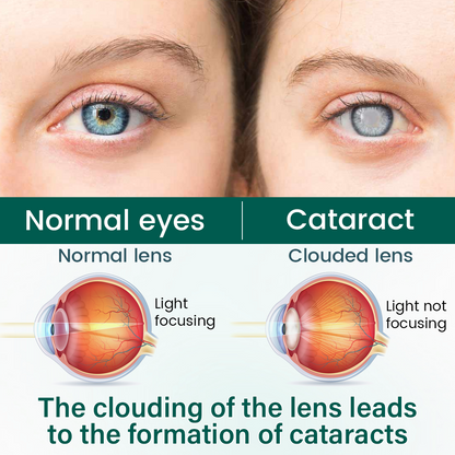 OptiClear Nano Eye Roller Serum