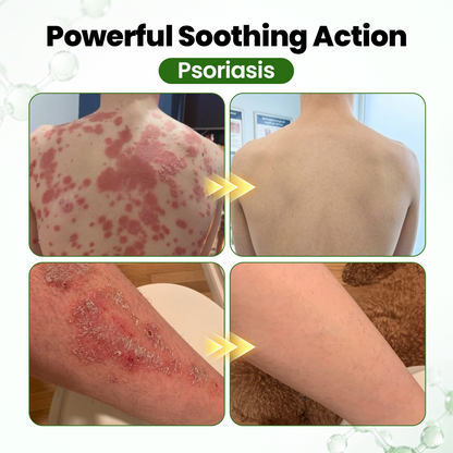 DermaOat Botanical Barrier Cream