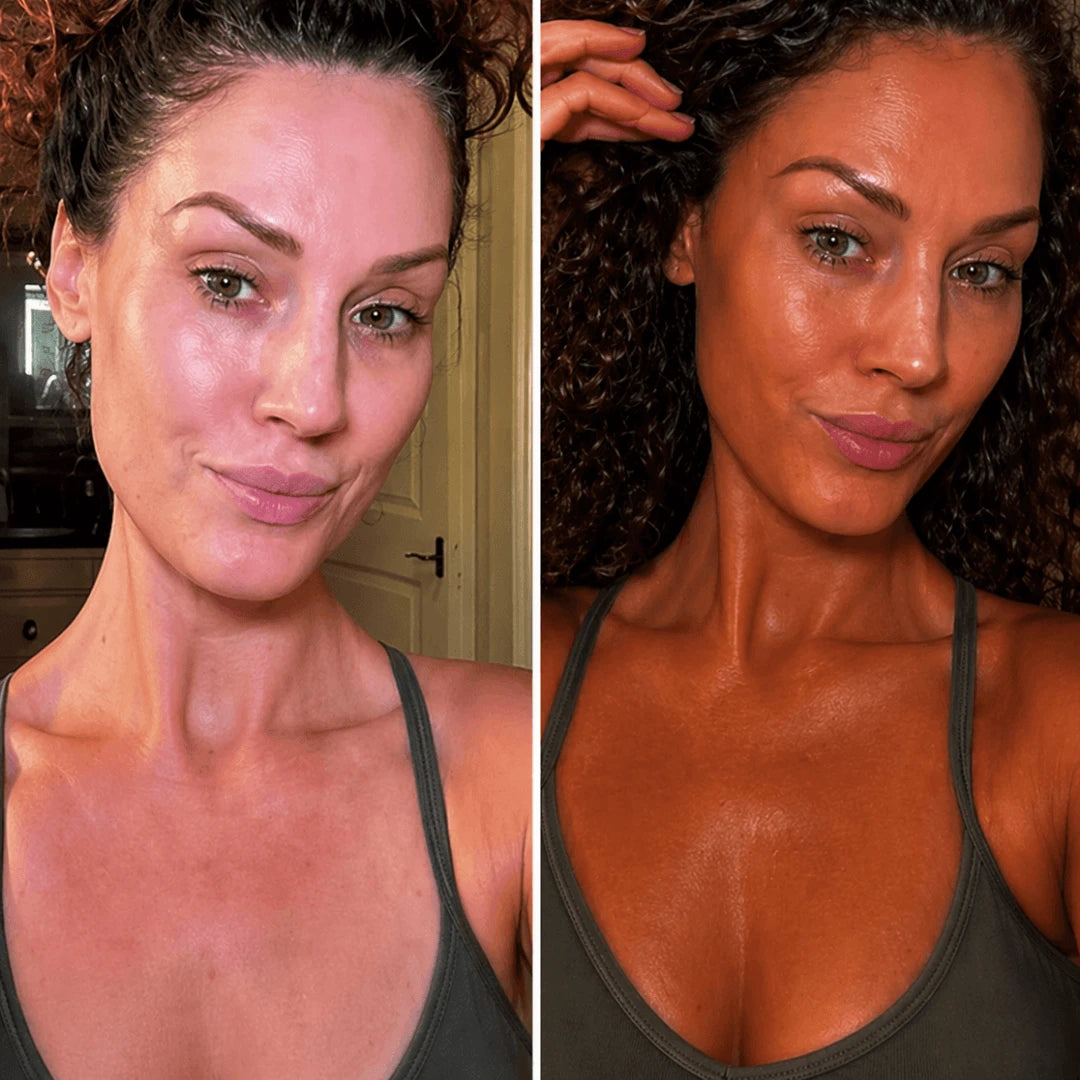 Noa K. before and after